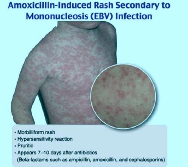 escort Nivari
