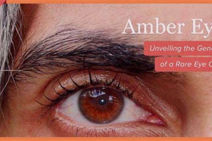 Iris, 31, a red amber-eyed asian companion based in Cornella de Llobregat. Offering Striptease, Girlfriend Experience, Travel Companion, Domination. Availabl...